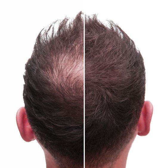 Power Hair Shampoo (anticaída) 250ml - Hey Joe